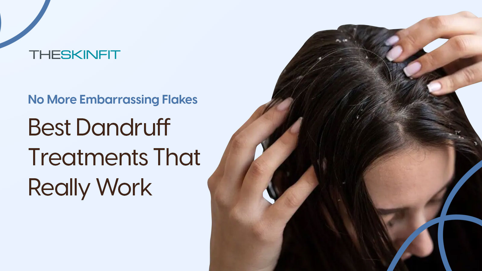 Flake-Free Forever: The Ultimate Guide To Dandruff Treatment