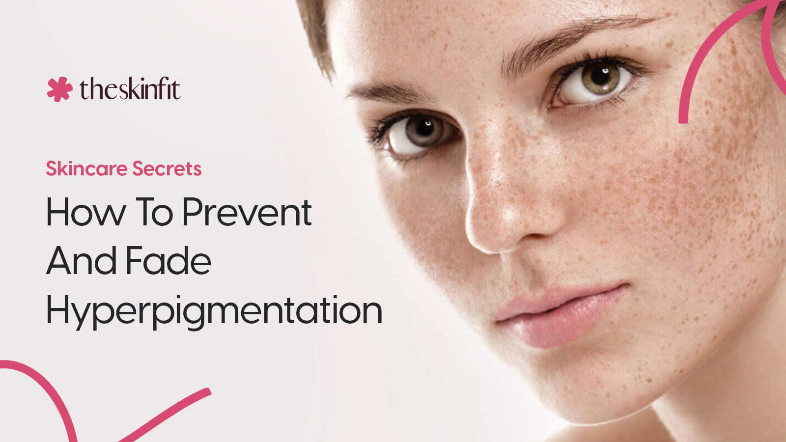 Skincare Secrets: How To Prevent And Fade Hyperpigmentation 